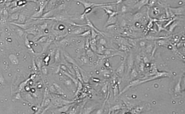 LX-2 Cas9 Human Hepatic Stellate Cell Line | SCC613